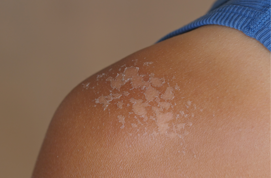 Summer Travel Health Tips