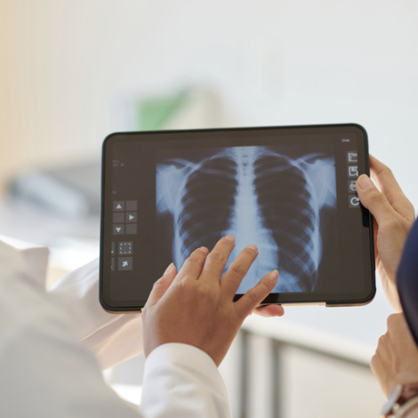 chest xray